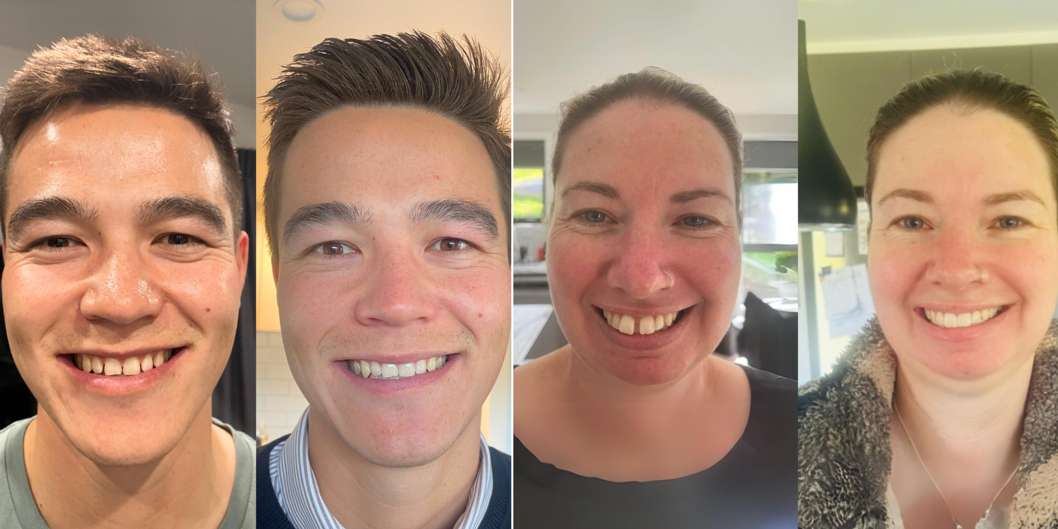 Aligners: Closing the Gap in Your Smile